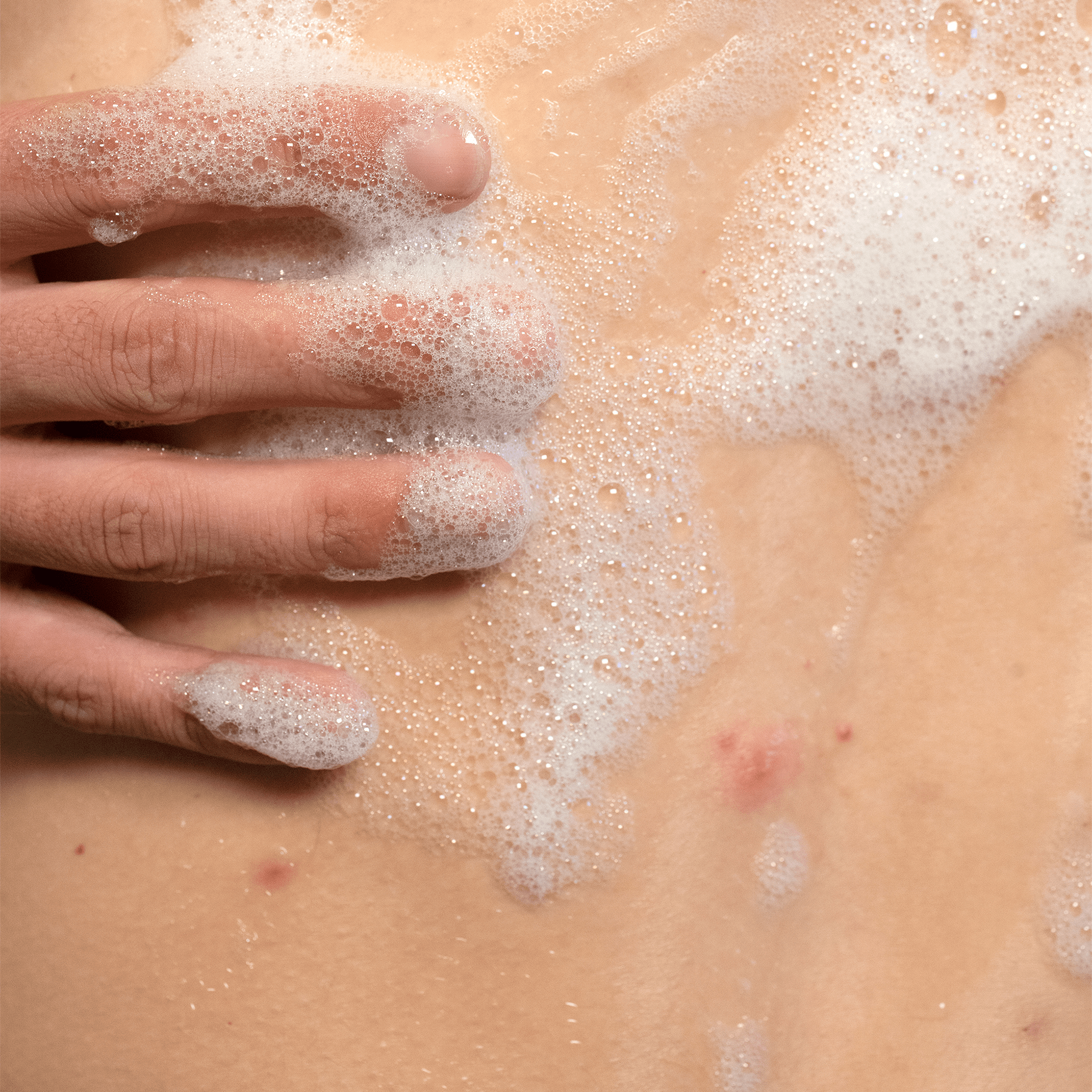 clear start back treatment