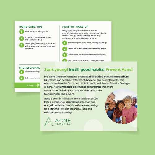 Acne Remedies Start Early Marketing Cards - Pack of 15