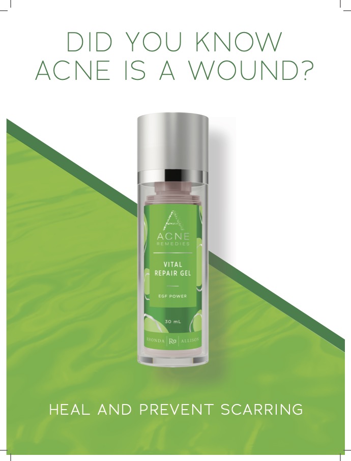 Acne Remedies Counter Card - Vital Repair